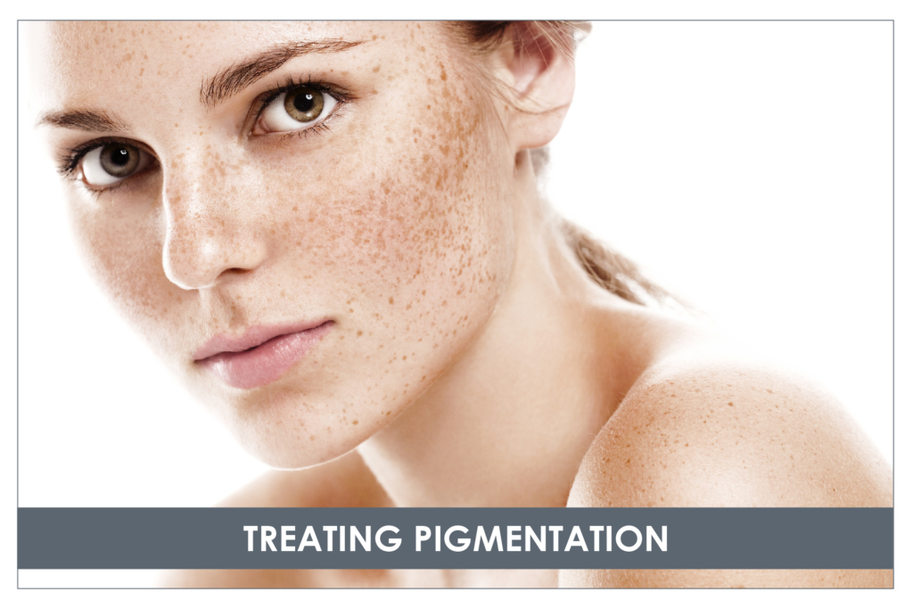 NATURAL CURE FOR PIGMENTATION IN THE FACE