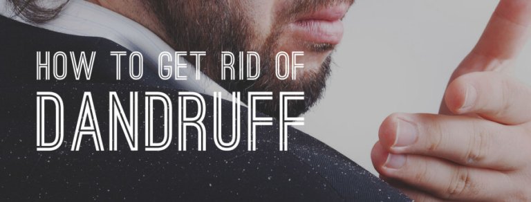 THE MAIN RESOURCES OF THE HOME TO GET RID OF THE DANDRUFF
