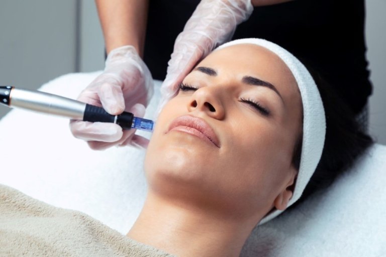 What is a Vampire Facial?