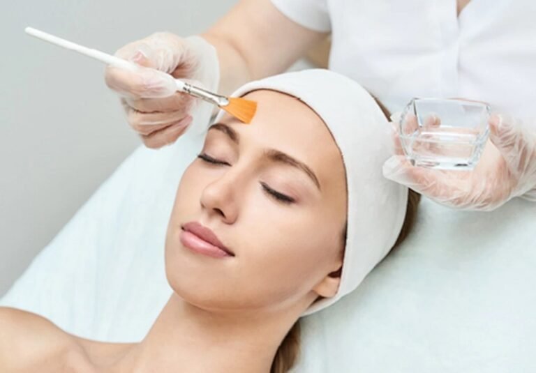 Transform Your Skin: The Benefits, Procedure, and Results of Chemical Peels for Acne Scars