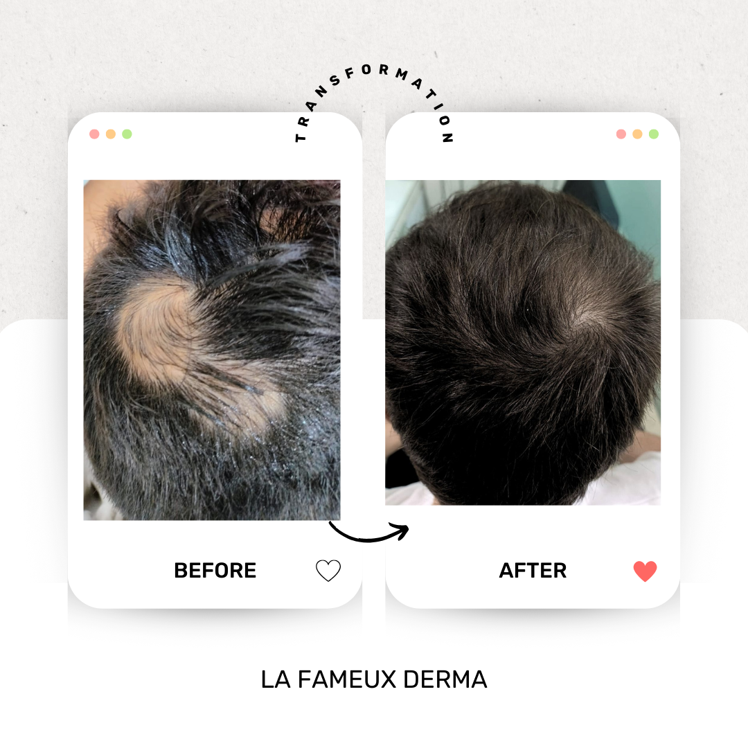 BEFORE & AFTER HAIR