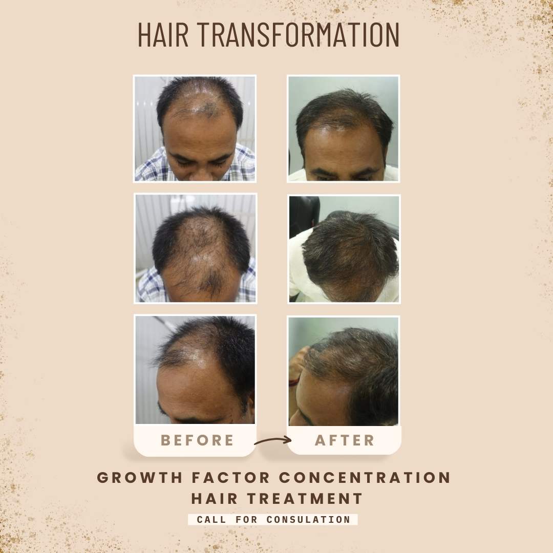 Hair Transformation