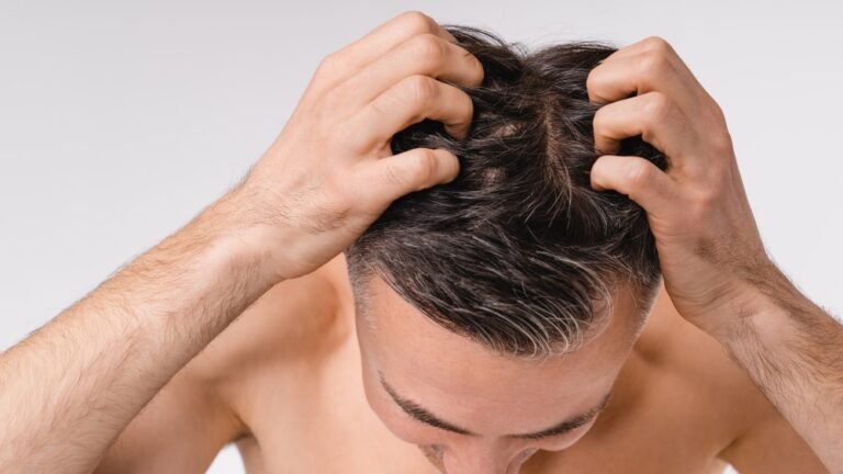 What Causes Hair Fall & How to Stop It?