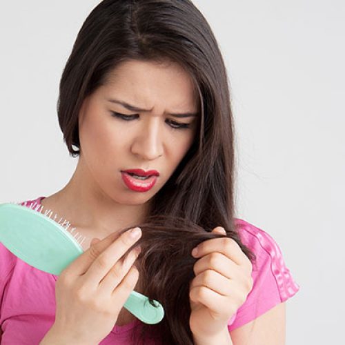 Causes of Hair Loss in Teenagers: Treatment and Prevention
