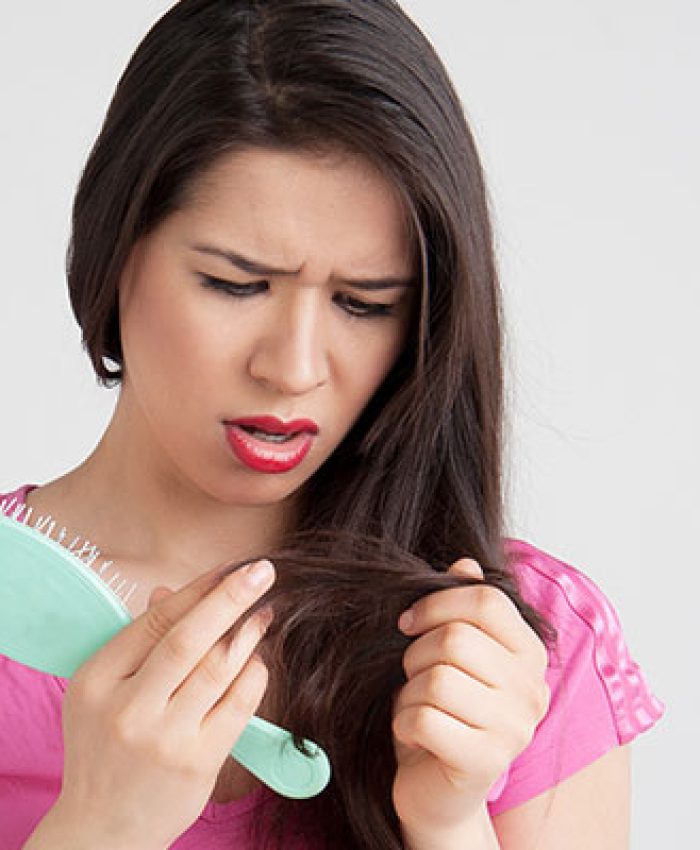 Causes of Hair Loss in Teenagers: Treatment and Prevention