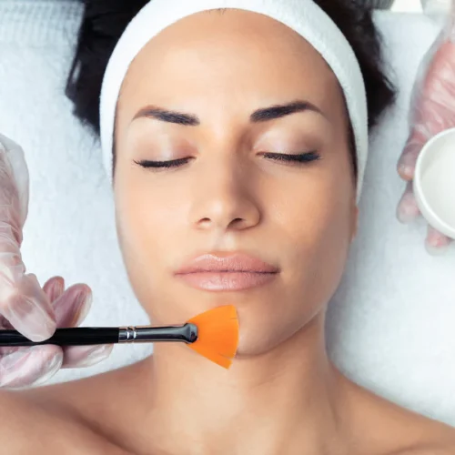Chemical Peels for Acne: How They Work, Types, Benefits & Side Effects