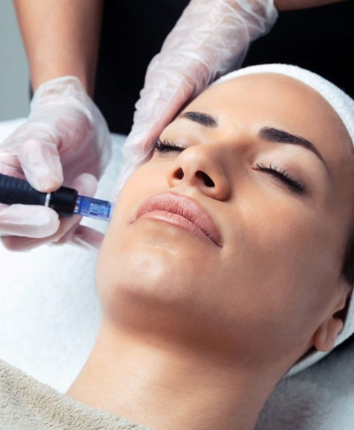 What is a Vampire Facial?