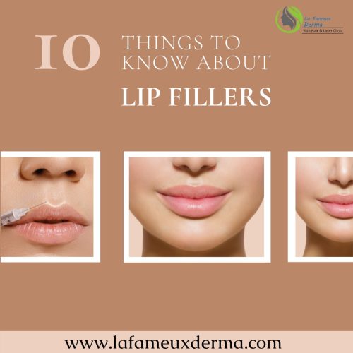 10 Things to Know Before Having Lip Fillers