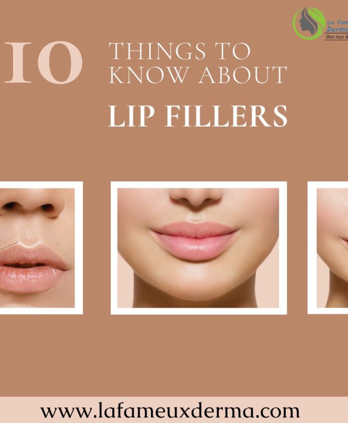 10 Things to Know Before Having Lip Fillers