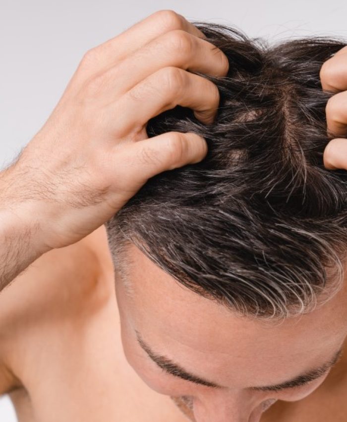 What Causes Hair Fall & How to Stop It?