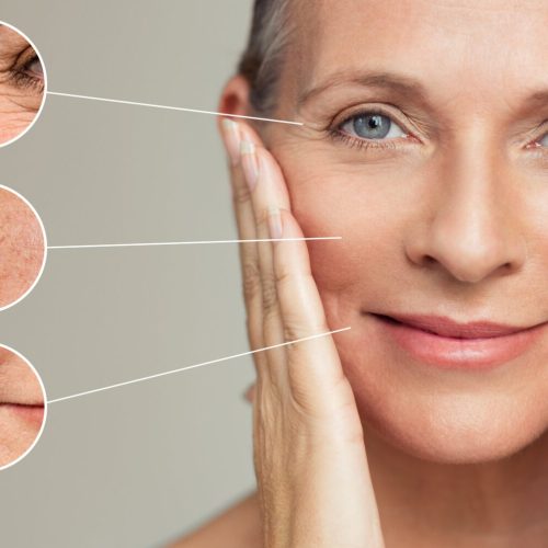 How to Choose the Right Anti-Ageing Treatment for Your Skin Type