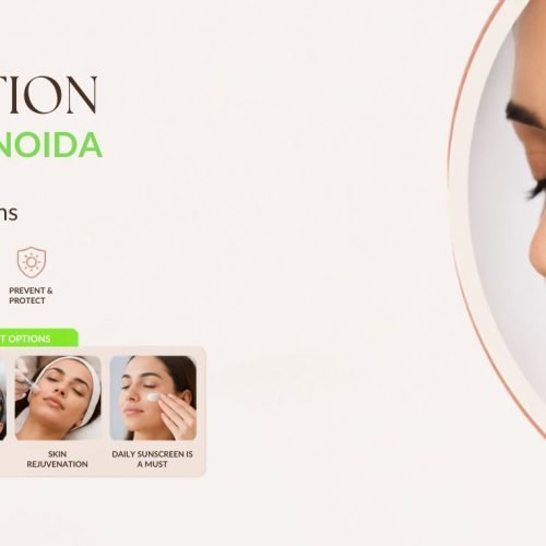 Pigmentation Treatment in Noida: Causes, Types & Effective Treatment Options