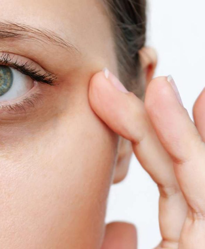 Dark Circles Under Eyes: Causes, Treatments, Results and Prevention Tips
